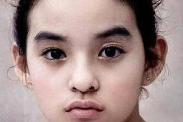 探讨女性没有下巴的命运与生活:外貌与内心的深度交织 探讨女性没有下巴的命运与生活:外貌与内心的深度交织