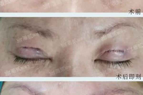 为什么眼皮受伤命好:解密眼皮受伤后的生存之道 为什么眼皮受伤命好:解密眼皮受伤后的生存之道