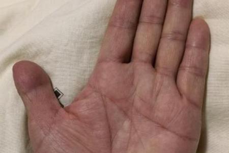 手指短粗男人的命运解析：这背后藏着什么秘密？