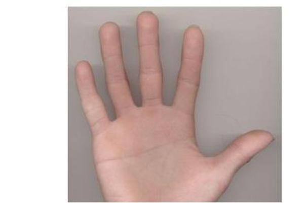 断掌命格解析:那些与众不同的人生轨迹 断掌命格解析:那些与众不同的人生轨迹