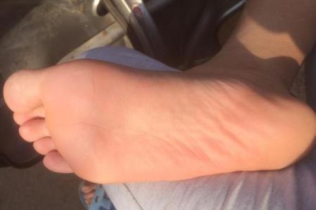 揭秘脚底黑点的含义：如何解读你脚下的秘密命运