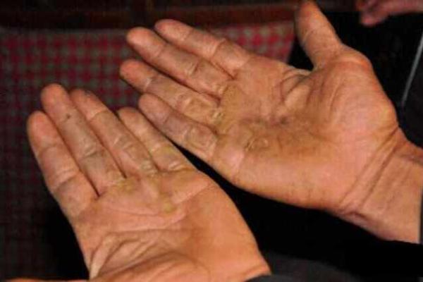 手掌与胳膊粗细：命运与人生的神秘联系