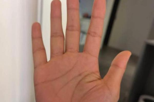 手指纹理的奥秘：解密你我命运的密码