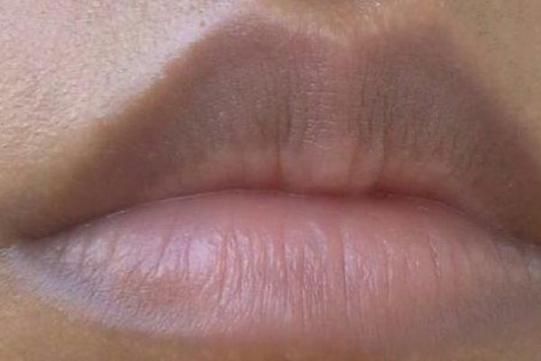 嘴唇下方有疤的命运解析:背后的深意与生活启示 嘴唇下方有疤的命运解析:背后的深意与生活启示