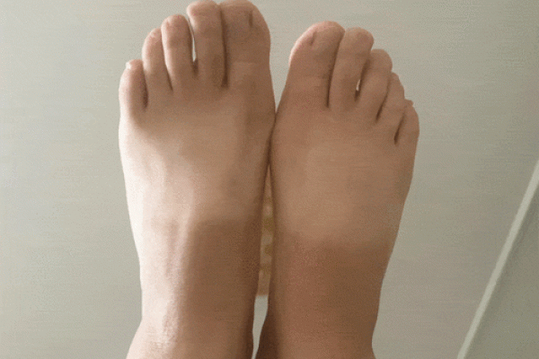 脚跟长的人命运揭秘:你的脚跟藏着哪些人生奥秘? 脚跟长的人命运揭秘:你的脚跟藏着哪些人生奥秘?