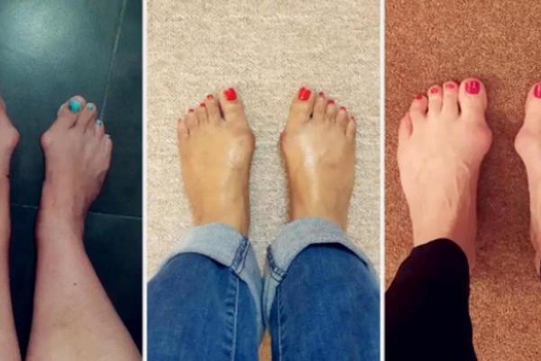 女人看脚型与命运的奇妙关系:脚型揭秘人生轨迹 女人看脚型与命运的奇妙关系:脚型揭秘人生轨迹