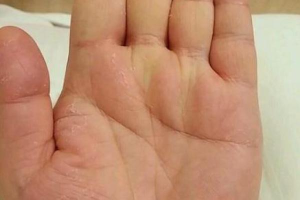 手指粗短的男人，命运是否注定？探寻人生的不同可能性