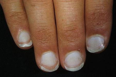 女人指甲软的秘密：揭示健康与命运的奥秘