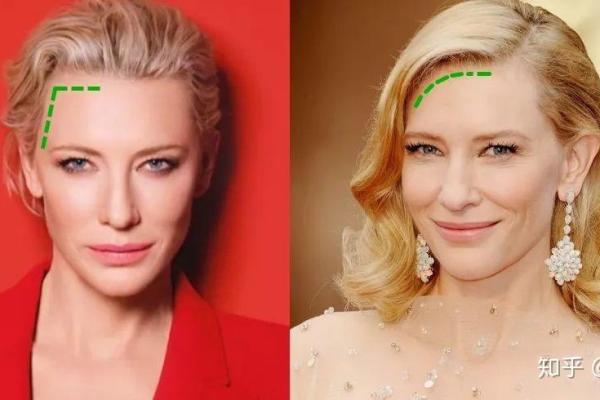 发际线靠后的人生玄机：如何逆袭命运，塑造更好的自己