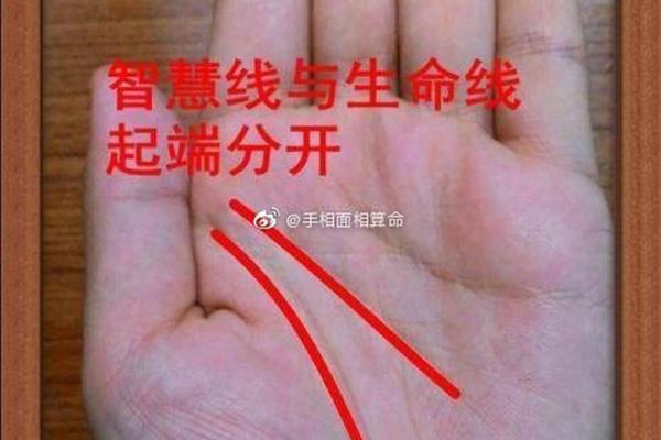 食指上的黑点代表什么?揭开命理学中的秘密! 食指上的黑点代表什么?揭开命理学中的秘密!