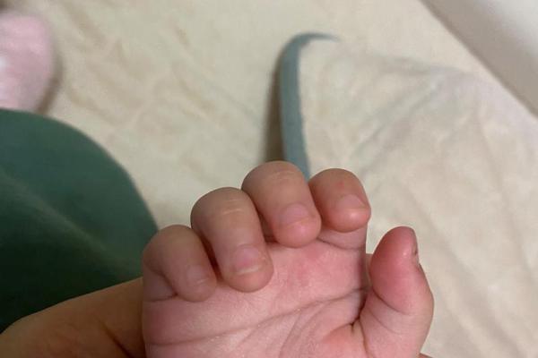 双手断掌女性命运解析:暗藏财富与创造力的秘密 双手断掌女性命运解析:暗藏财富与创造力的秘密