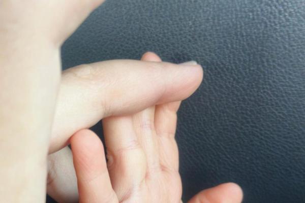 手指没有指肚,何以掌握人生的方向? 手指没有指肚,何以掌握人生的方向?