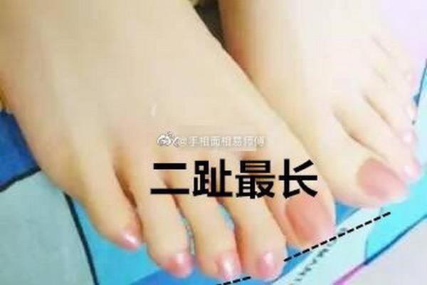 脚拇指上翘的命运解读:揭示你潜藏的性格与运势! 脚拇指上翘的命运解读:揭示你潜藏的性格与运势!