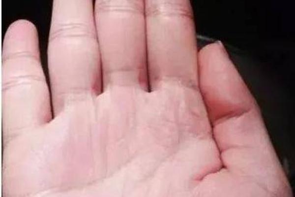 大拇指粗大的人命运解析:你的性格与人生走向! 大拇指粗大的人命运解析:你的性格与人生走向!