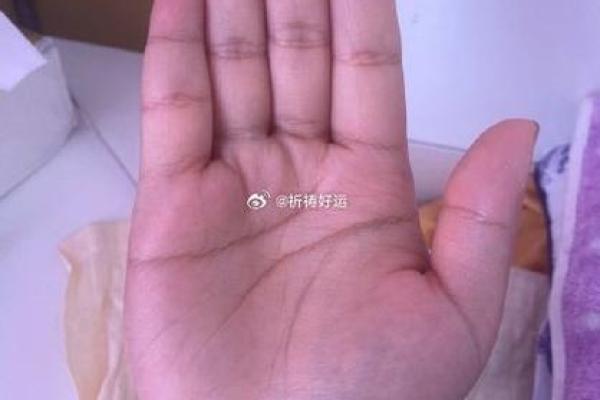 指纹与命运的秘密：探寻十种指纹图案的命运之谜