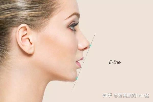 下巴严重后缩的影响与改善方法探讨,重拾自信人生! 下巴严重后缩的影响与改善方法探讨,重拾自信人生!