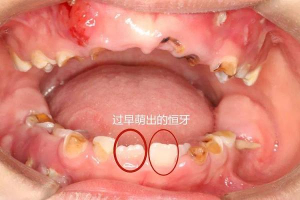 探索31颗牙齿的奥秘：它们在命运中的象征意义与启示