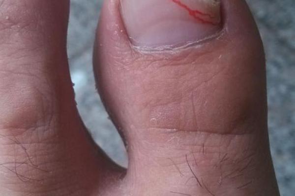 揭示大脚拇指长度与命运的秘密,了解你的指尖魅力! 揭示大脚拇指长度与命运的秘密,了解你的指尖魅力!