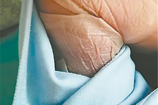 胳膊短的人，命运如何？揭开短胳膊背后的秘密与故事