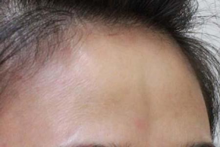 额头撞破了，究竟潜藏着怎样的命运启示？