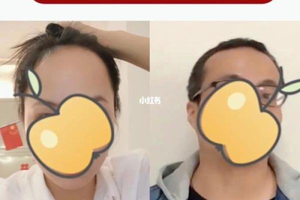 后脑发际线高的命运解析:命运与发际线之间的神秘联系 后脑发际线高的命运解析:命运与发际线之间的神秘联系