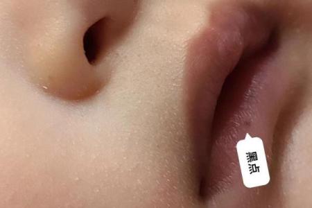 嘴唇上的黑点象征着什么？密切关注这些“命理”信号！
