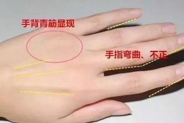 男性左手背纹路的秘密与命运解析 男性左手背纹路的秘密与命运解析