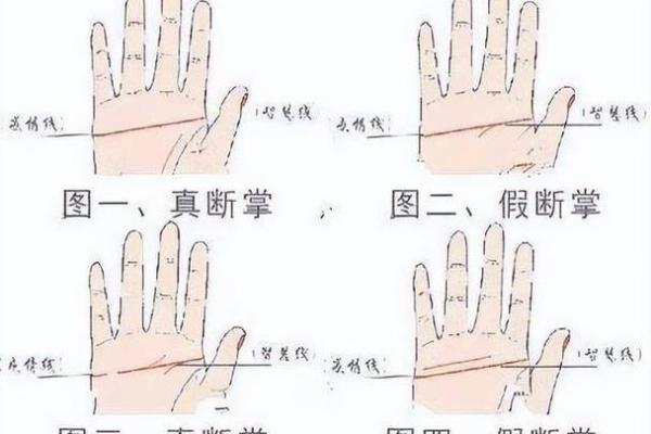 双手断掌:命运的象征与人生的启示 双手断掌:命运的象征与人生的启示