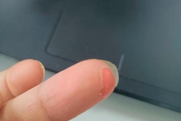 手指长得没有肉,影响命运的神秘解读 手指长得没有肉,影响命运的神秘解读