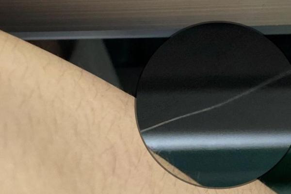 女人腿长毛是什么命？解读腿毛与命运的奇妙关系