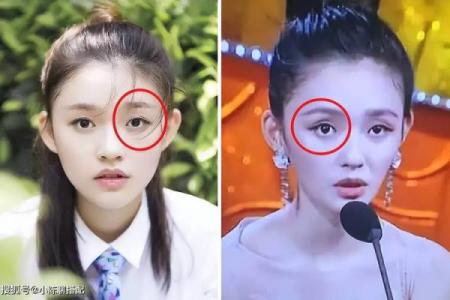 女人眼窝深陷的命运解析：深眼窝背后的秘密与影响