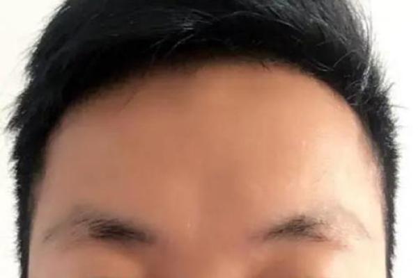 男性无眉毛的命运分析：缺少眉毛对男性性格与生活的影响