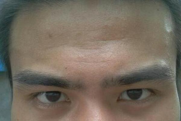 男性无眉毛的命运分析：缺少眉毛对男性性格与生活的影响