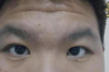 没有鼻梁男生的命运揭秘：从外貌到内心的故事