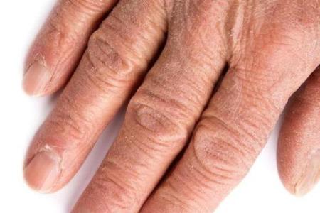 手背露青筋，揭示生命奥秘与命运走向