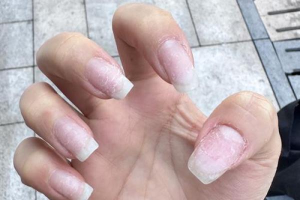 男人指甲丑陋背后隐藏的命运秘密与生活态度 男人指甲丑陋背后隐藏的命运秘密与生活态度