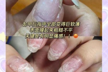 男人指甲丑陋背后隐藏的命运秘密与生活态度