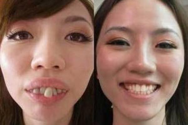 尖牙利嘴命格解析:如何看待这一命运特征的独特魅力 尖牙利嘴命格解析:如何看待这一命运特征的独特魅力