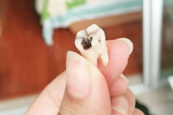 男生牙齿形态与命运的神秘关联:探寻30颗牙的奥秘! 男生牙齿形态与命运的神秘关联:探寻30颗牙的奥秘!