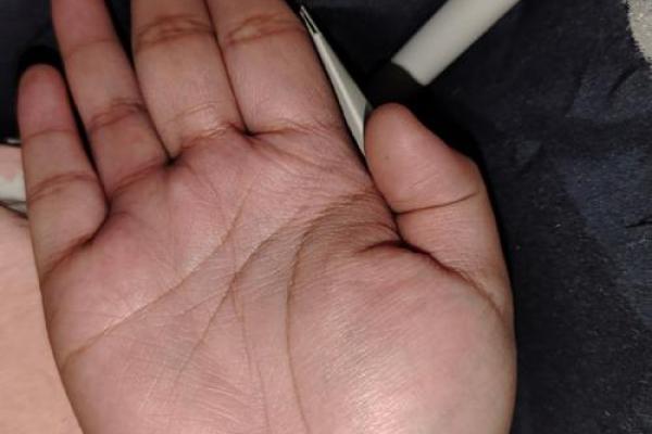 男手掌颜色暗红揭示的命运密码,深度解读你不可忽视的特征 男手掌颜色暗红揭示的命运密码,深度解读你不可忽视的特征