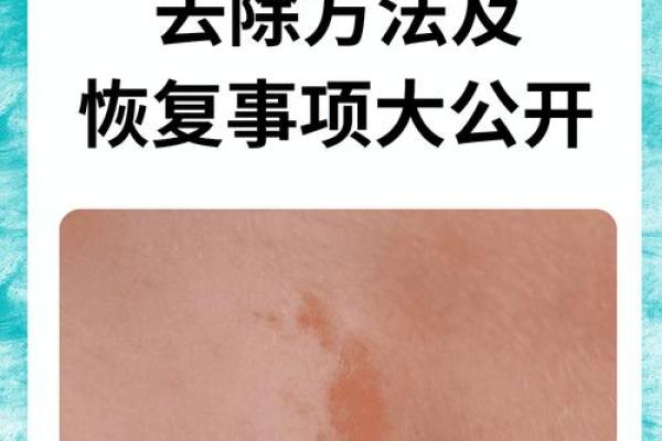 身上胎记的秘密:探秘你命运的印记与象征 身上胎记的秘密:探秘你命运的印记与象征