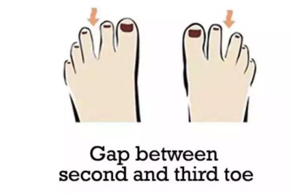 大脚趾太长,命运与性格的奇妙关联探讨 大脚趾太长,命运与性格的奇妙关联探讨