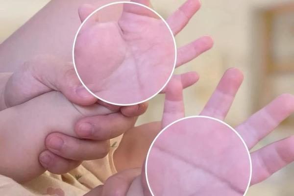 双手断掌男子命运解读:迷雾中寻找自我之路 双手断掌男子命运解读:迷雾中寻找自我之路