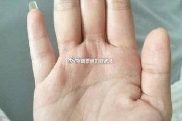双手断掌男子命运解读:迷雾中寻找自我之路 双手断掌男子命运解读:迷雾中寻找自我之路