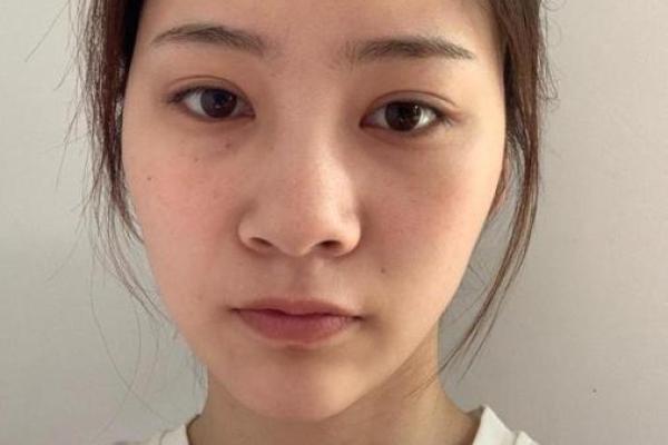 露鼻孔的人是什么命,揭示面相中的秘密与命运解析 露鼻孔的人是什么命,揭示面相中的秘密与命运解析