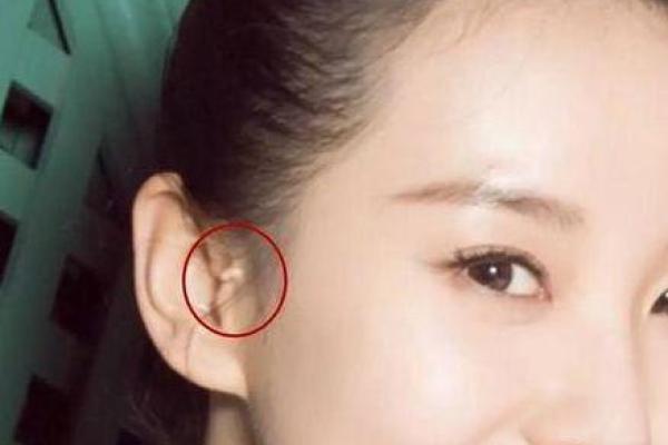 双耳朵尖的人命运解析：独特性格与人生道路的秘密