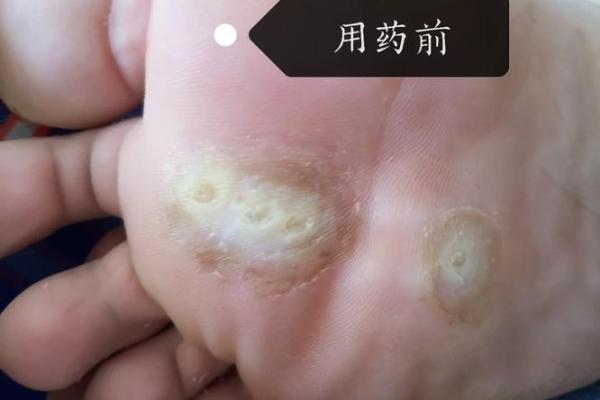 眼角长猴子,命运何解:带你揭开这一现象的神秘面纱 眼角长猴子,命运何解:带你揭开这一现象的神秘面纱