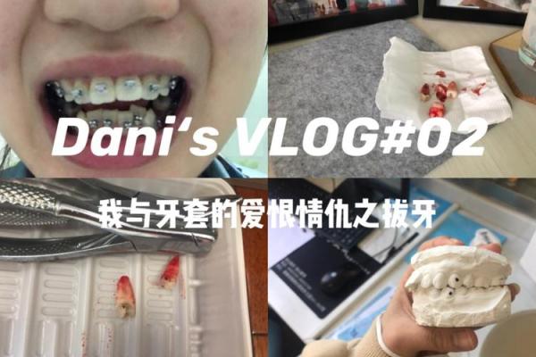 女人29颗牙的命运与生活的奇妙关系 女人29颗牙的命运与生活的奇妙关系