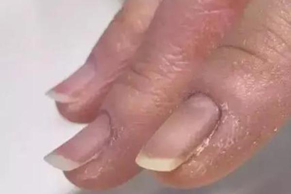 指甲往上翘:你身上的命运密码! 指甲往上翘:你身上的命运密码!