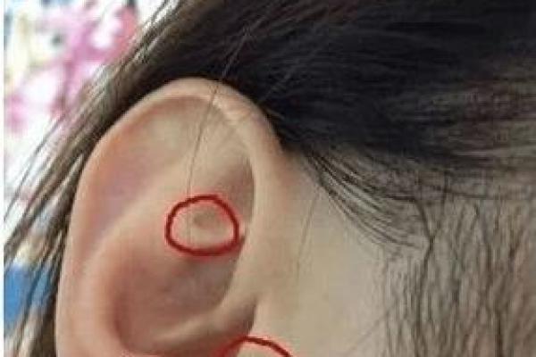 耳垂的秘密:揭示富贵命的隐藏特征与生活智慧 耳垂的秘密:揭示富贵命的隐藏特征与生活智慧